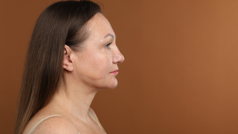 Milton Seigi Hayashi afirma que não existe melhor técnica, mas a rinoplastia certa para cada caso.